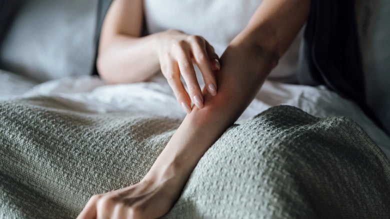 Coconut Oil for Eczema & Rashes